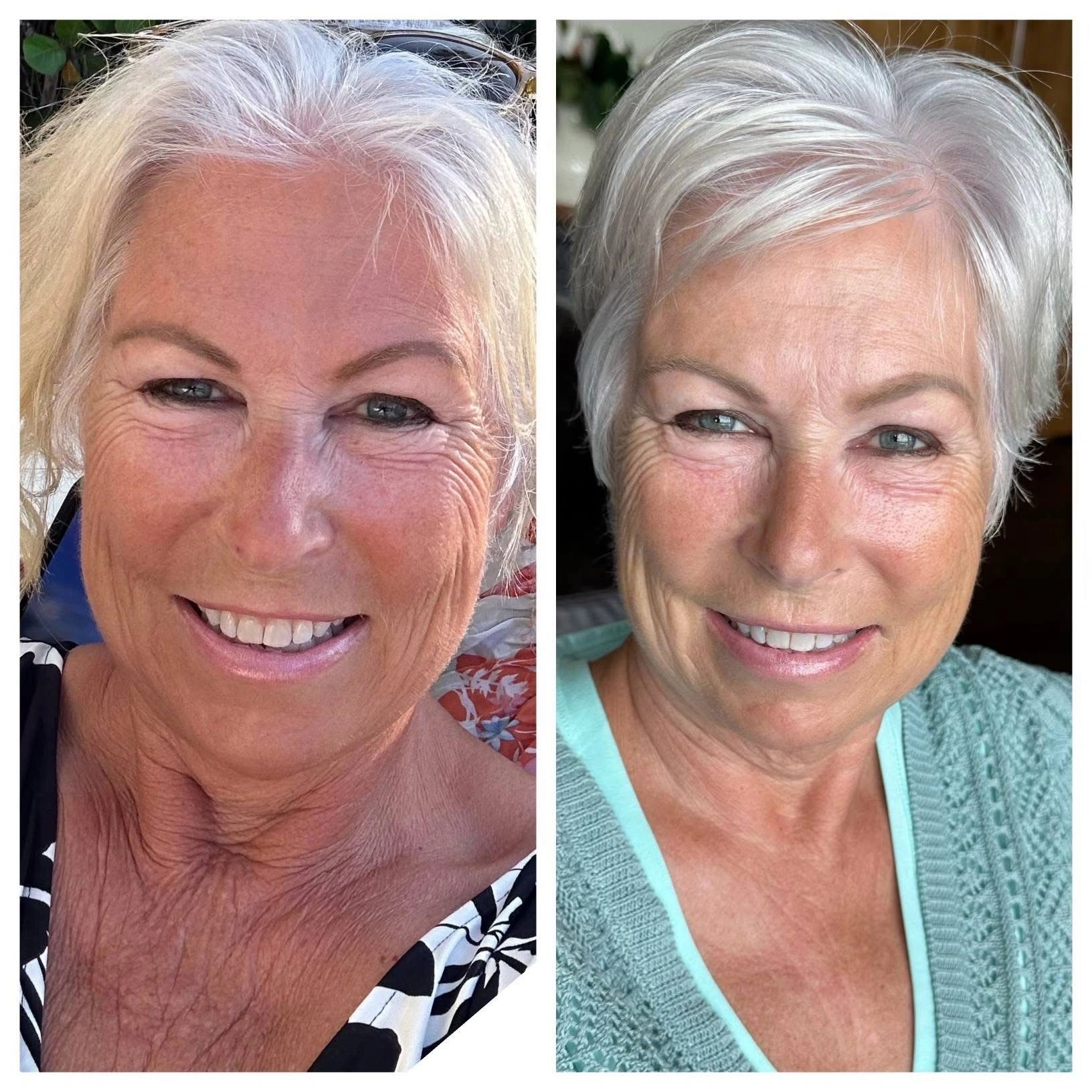 Client before and after LifeWave X39 phototherapy patches