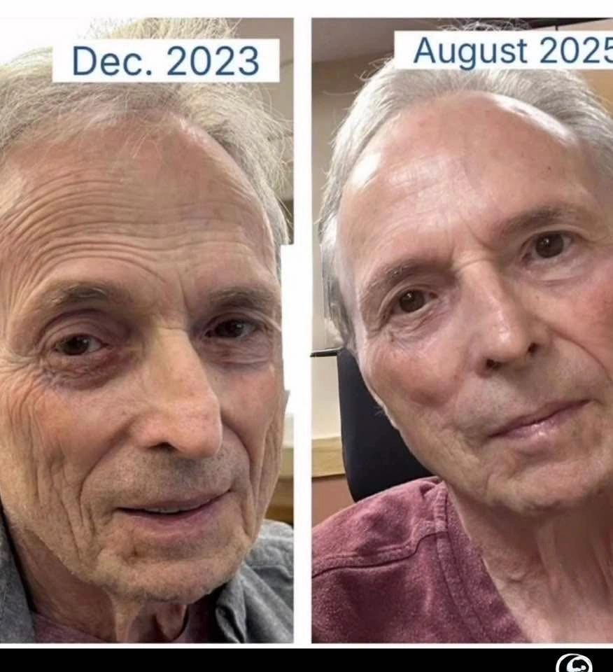 Client before and after LifeWave X39 patches, December 2023 to August 2025